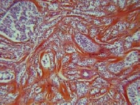 Skin zoom (Look Like) - similarity