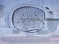 Artificial insemination (Look Like) - similarity